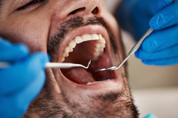Best Dentist for Tooth Abscess  in Peabody, KS
